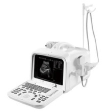 Digitale Ultraschall-Diagnose-System
